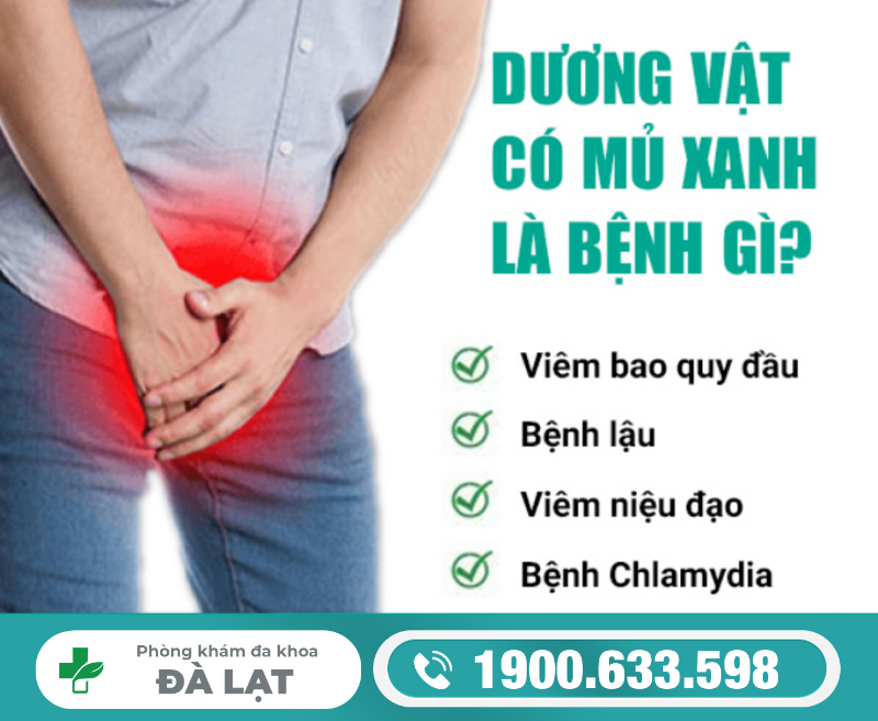 Hình ảnh minh họa